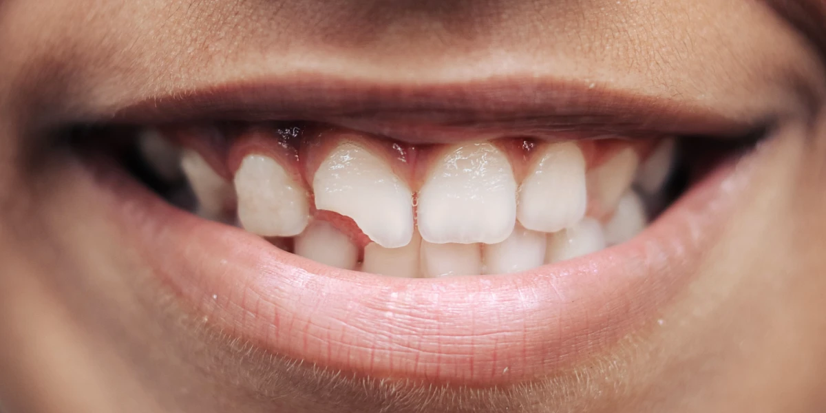 urgencias dentales goya banner 3.webp