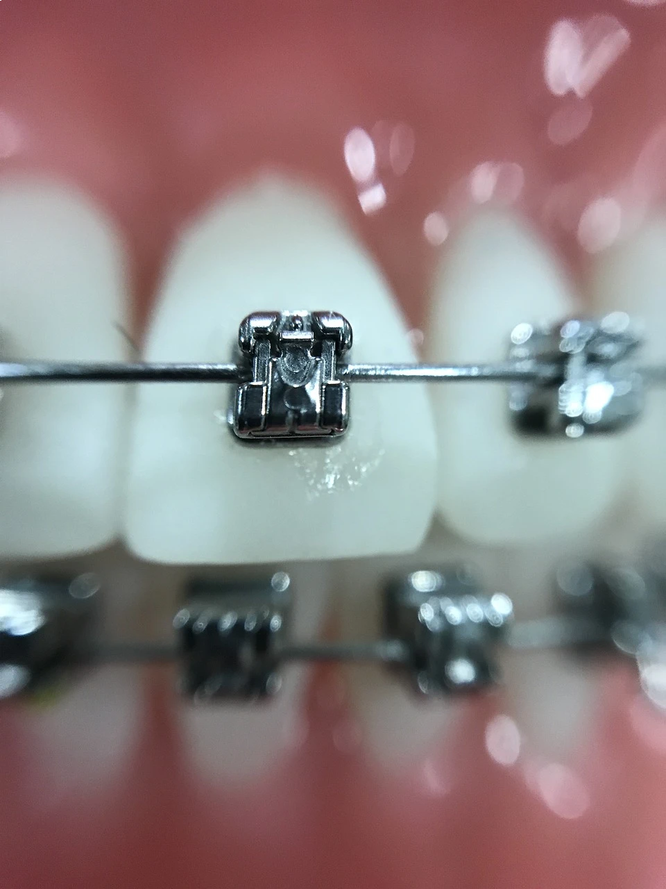 brackets-madrid-detalle-de-brackets-metalicos