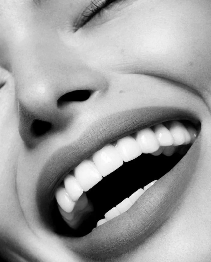 estetica dental goya mujer sonriendo
