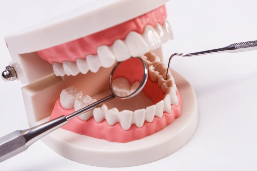 odontologia conservadora madrid maqueta explicativa boca