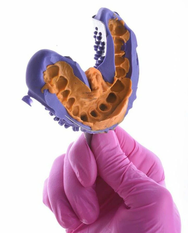 protesis dentales goya realizacion de molde para protesis