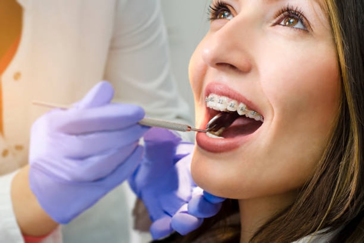 Closeup of beautiful girl with dental braces check up, satisfied smiling, while doctor looking her teeth
