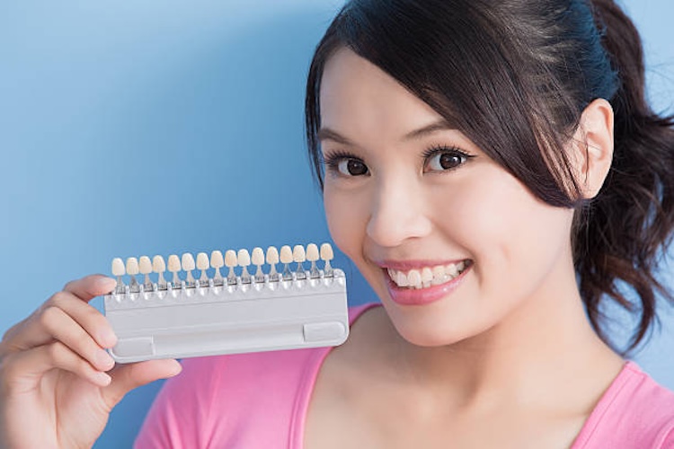 beneficios de la odontologia estetica para tu sonrisa 2