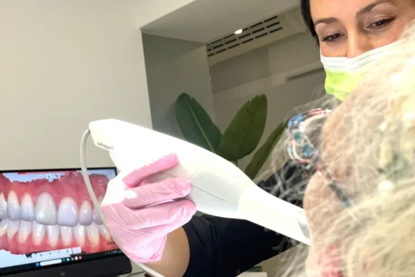 clinica-dental-nunez-cobos-escaner-intraoral